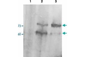 PCSK9 polyclonal antibody  staining (0. (PCSK9 抗体  (C-Term))