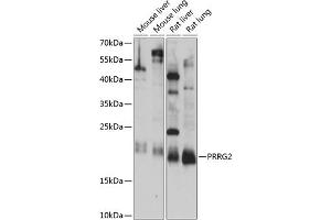 Western blot analysis of extracts of various cell lines, using PRRG2 antibody (ABIN7269558) at 1:1000 dilution. (PRRG2 抗体  (AA 1-179))