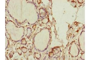Immunohistochemistry of paraffin-embedded human thyroid tissue using ABIN7170585 at dilution of 1:100 (SPICE1 抗体  (AA 1-220))