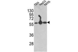 Western blot analysis of AP17615PU-N P4HB antibody (C-term) in CEM,HepG2, A2058 cell line lysates (35 µg/lane). (P4HB 抗体  (C-Term))