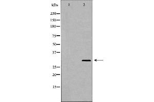 Western blot analysis of extracts of HL-60 , using TNFRSF14 antibody. (HVEM 抗体  (C-Term))