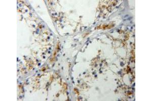 Used in DAB staining on fromalin fixed paraffin-embedded testis tissue (IGF2 抗体  (AA 25-91))