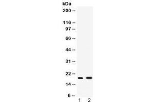 Western blot testing of 1) mouse spleen and 2) mouse liver lysate with PYY antibody at 0. (Peptide YY 抗体  (AA 29-64))