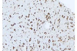 ABIN6273036 at 1/100 staining Mouse brain tissue by IHC-P. (Complexin 1 抗体  (N-Term))