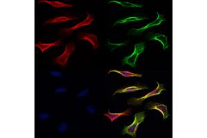 ABIN6260870 and ABIN6266837 staining Hela by IF/ICC.
