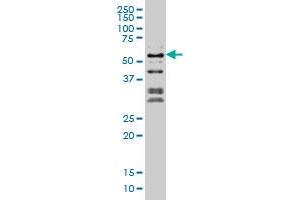 NFIC monoclonal antibody (M03), clone 1D6 Western Blot analysis of NFIC expression in Hela S3 NE . (NFIC 抗体  (AA 314-423))