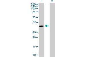 Western Blot analysis of THAP1 expression in transfected 293T cell line by THAP1 MaxPab polyclonal antibody. (THAP1 抗体  (AA 1-213))