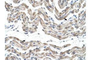 SFRS10 antibody was used for immunohistochemistry at a concentration of 4-8 ug/ml to stain Skeletal muscle cells (arrows) in Human Muscle. (TRA2B 抗体)