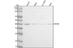 anti-NOL1/NOP2/Sun Domain Family, Member 4 (NSUN4) (AA 1-379) antibody
