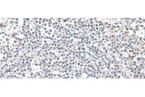 Immunohistochemistry of paraffin-embedded Human tonsil tissue using PAM16 Polyclonal Antibody at dilution of 1:60(x200) (MAGMAS 抗体)