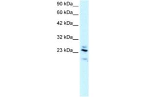 Western Blotting (WB) image for anti-Regulator of G-Protein Signaling 20 (RGS20) antibody (ABIN2460854) (RGS20 抗体)