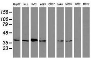 Image no. 3 for anti-Melanoma Antigen Family B, 1 (MAGEB1) antibody (ABIN1499266) (MAGEB1 抗体)