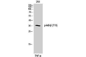 Western Blotting (WB) image for anti-NF-kappa-B inhibitor beta (NFKBIB) (pThr19) antibody (ABIN3180433) (NFKBIB 抗体  (pThr19))