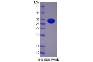 SDS-PAGE analysis of Mouse SCEL Protein. (SCEL 蛋白)