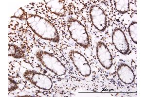 Immunoperoxidase of monoclonal antibody to SOCS3 on formalin-fixed paraffin-embedded human colon. (SOCS3 抗体  (AA 1-225))