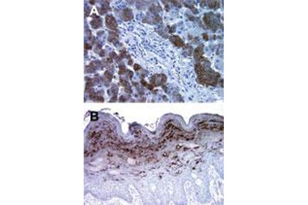 Bax Inhibitor 1 抗体  (C-Term, N-Term)