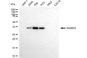 anti-Ras Association (RalGDS/AF-6) Domain Family Member 2 (RASSF2) antibody