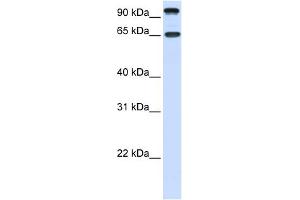 WB Suggested Anti-NTRK3 Antibody Titration:  0. (NTRK3 抗体  (C-Term))