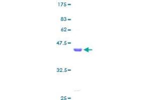 LMO3 Protein (AA 1-145) (GST tag)