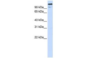 Western Blotting (WB) image for anti-Zinc Finger and BTB Domain-Containing Protein 10 (ZBTB10) antibody (ABIN2458278) (ZBTB10 抗体)