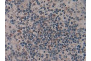 Immunohistochemistry (IHC) image for anti-Plasminogen Activator, Tissue (PLAT) antibody (ABIN7431908)