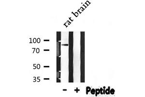 Western Blotting (WB) image for anti-Neural Precursor Cell Expressed, Developmentally Down-Regulated 9 (NEDD9) (Internal Region) antibody (ABIN6263585)