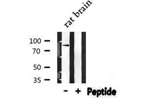 Western blot analysis of NEDD9 expression in Rat brain lysate