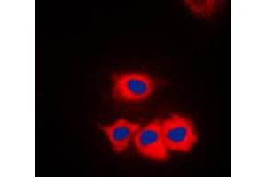 Immunofluorescent analysis of SSBP1 staining in HeLa cells. (SSBP1 抗体  (C-Term))