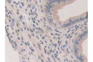 Detection of ERa in Mouse Uterus Tissue using Polyclonal Antibody to Estrogen Receptor Alpha (ERa) (Estrogen Receptor alpha 抗体  (AA 233-483))