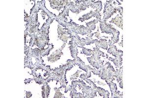 IHC analysis of MPI using anti-MPI antibody (ABIN4886672).