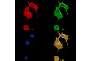 ABIN6260322 and ABIN6279883 staining HepG2 cells by IF/ICC. (BTF3L4 抗体  (Internal Region))