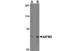 Image no. 1 for anti-Apoptosis-Inducing Factor, Mitochondrion-Associated, 3 (AIFM3) (N-Term) antibody (ABIN1494348) (AIFM3 抗体  (N-Term))