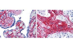 Anti collagen VI antibody (1:400 45 min RT) showed strong staining in FFPE sections of human placenta (Left) with red staining of stromal and extracellular spaces, and in testis (Right) with staining of extracellular spaces between seminiferous tubules). (COL6 抗体  (Biotin))