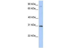 ABHD13 antibody used at 1 ug/ml to detect target protein. (ABHD13 抗体  (C-Term))