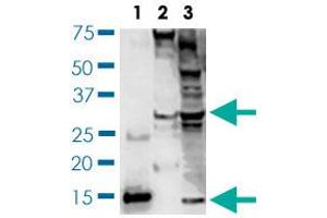 Western blot (Cell lysate) analysis of BDNF expression of SH-SY5Y cell lysates. (BDNF 抗体)