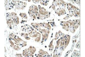 Image no. 1 for anti-Carbohydrate (Keratan Sulfate Gal-6) Sulfotransferase 1 (CHST1) (AA 74-123) antibody (ABIN320945) (CHST1 抗体  (AA 74-123))