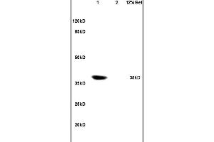 Lane 1: rat heart lysates Lane 2: rat embryo lysates probed with Anti Coxsackie Adenovirus Receptor Polyclonal Antibody, Unconjugated (ABIN739575) at 1:200 in 4C. (GM1123 抗体  (AA 21-120))