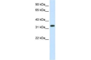 Western Blotting (WB) image for anti-E3 Ubiquitin-Protein Ligase SIAH1 (SIAH1) antibody (ABIN2461673)