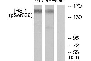 Immunohistochemistry analysis of paraffin-embedded human brain tissue using IRS-1 (Phospho-Ser636) antibody.