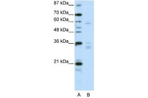 ZNF440 antibody (20R-1234) used at 0. (ZNF440 抗体  (N-Term))