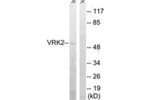 Western Blotting (WB) image for anti-Vaccinia Related Kinase 2 (VRK2) (AA 171-220) antibody (ABIN2890623) (VRK2 抗体  (AA 171-220))