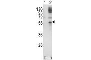 Western blot analysis of GATA2 (arrow) using rabbit polyclonal GATA2 Antibody (Center) . (GATA2 抗体  (Middle Region))