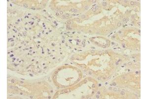 Immunohistochemistry of paraffin-embedded human kidney tissue using ABIN7175891 at dilution of 1:100 (RPGRIP1 抗体  (AA 400-580))