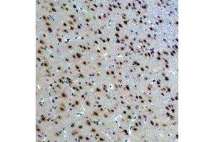 Immunohistochemical analysis of 14-3-3 epsilon staining in rat brain formalin fixed paraffin embedded tissue section. (YWHAE 抗体)