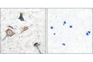 Immunohistochemistry analysis of paraffin-embedded human brain tissue, using MMP-16 Antibody. (MMP16 抗体  (AA 551-600))