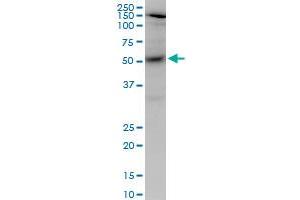 AKT1 monoclonal antibody (M03), clone 2E11. (AKT1 抗体  (AA 1-480))