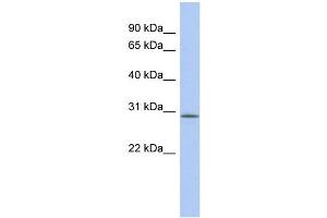 WB Suggested Anti-VSTM2A Antibody Titration: 0. (VSTM2A 抗体  (Middle Region))