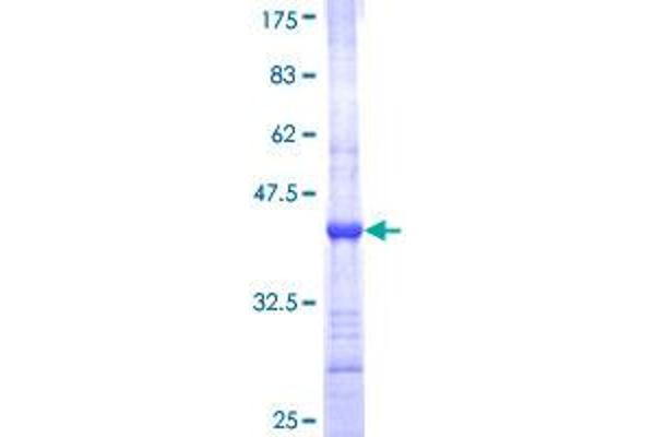 RPP29 Protein (AA 121-220) (GST tag)