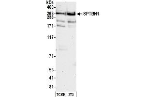 Western Blotting (WB) image for anti-Spectrin Beta, Non-Erythrocytic 1 (SPTBN1) (AA 2100-2150) antibody (ABIN7454694) (SPTBN1 抗体  (AA 2100-2150))