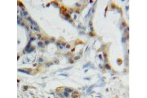 Used in DAB staining on fromalin fixed paraffin-embedded Pancreas tissue (CST6 抗体  (AA 29-149))